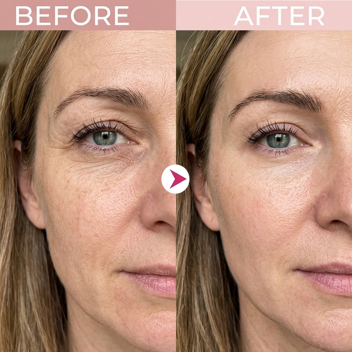 💖Loved & Trusted by Over 50,000 Women💖 Eye Renewal Crème